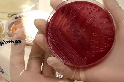 Estudo aponta 250 milhões de bactérias e fungos presentes nas baratas